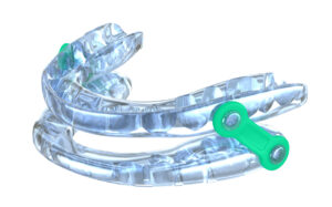 Oral appliance therapy device, sleep apnea treatment.3D illustration