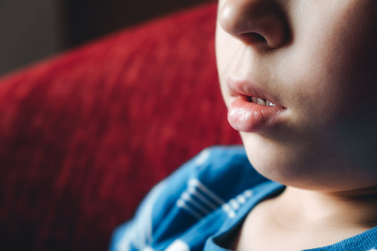Closeup face profile. Lips of child. 6 year boy with open mouth close-up. Weak facial muscles. Copy space. Mouth breathing. The concentrating kid. Nasal congestion. Dry air. Runny nose. White skin. 4K